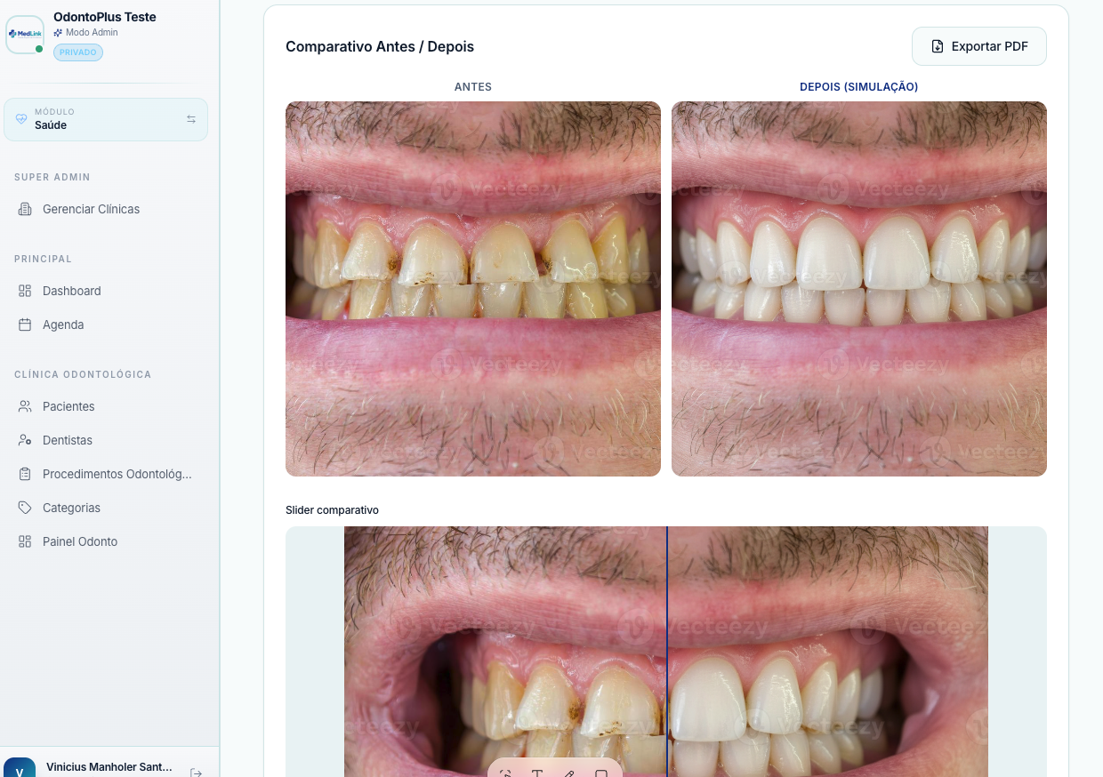 Digital Smile Design